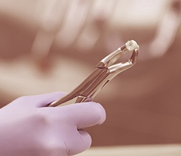 Dentist holding wisdom tooth with forceps