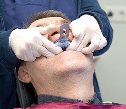 a dental assistance getting an impression of a patient’s teeth