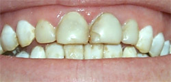 Before