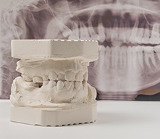 Example of dentures mold in Waterbury