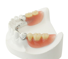 Model of a partial at a dentist for dentures in Waterbury.