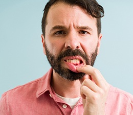 A young man suffering from gingivitis