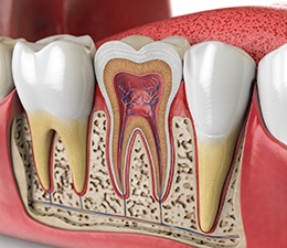 an illustration of a root canal in Waterbury