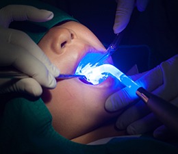 a child patient getting a dental sealant