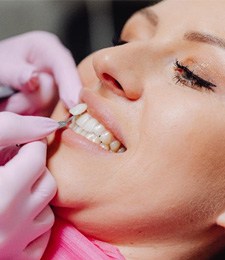 Woman at consultation for veneers