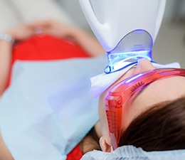 In-office teeth whitening treatment