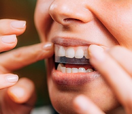 Closeup of patient putting on whitening strip