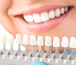 Shade guide for teeth whitening in Waterbury for a bright smile.