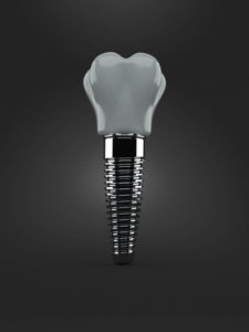 We provide dental implants in Waterbury to replace your missing teeth.