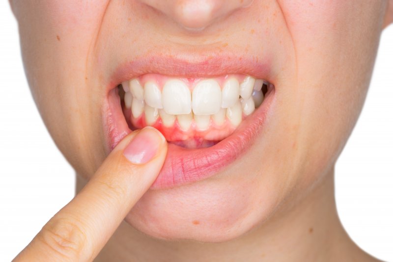 an up-close look at a person pulling down their lower lip and exposing their red gums