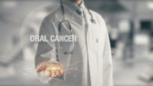 Physician for oral cancer
