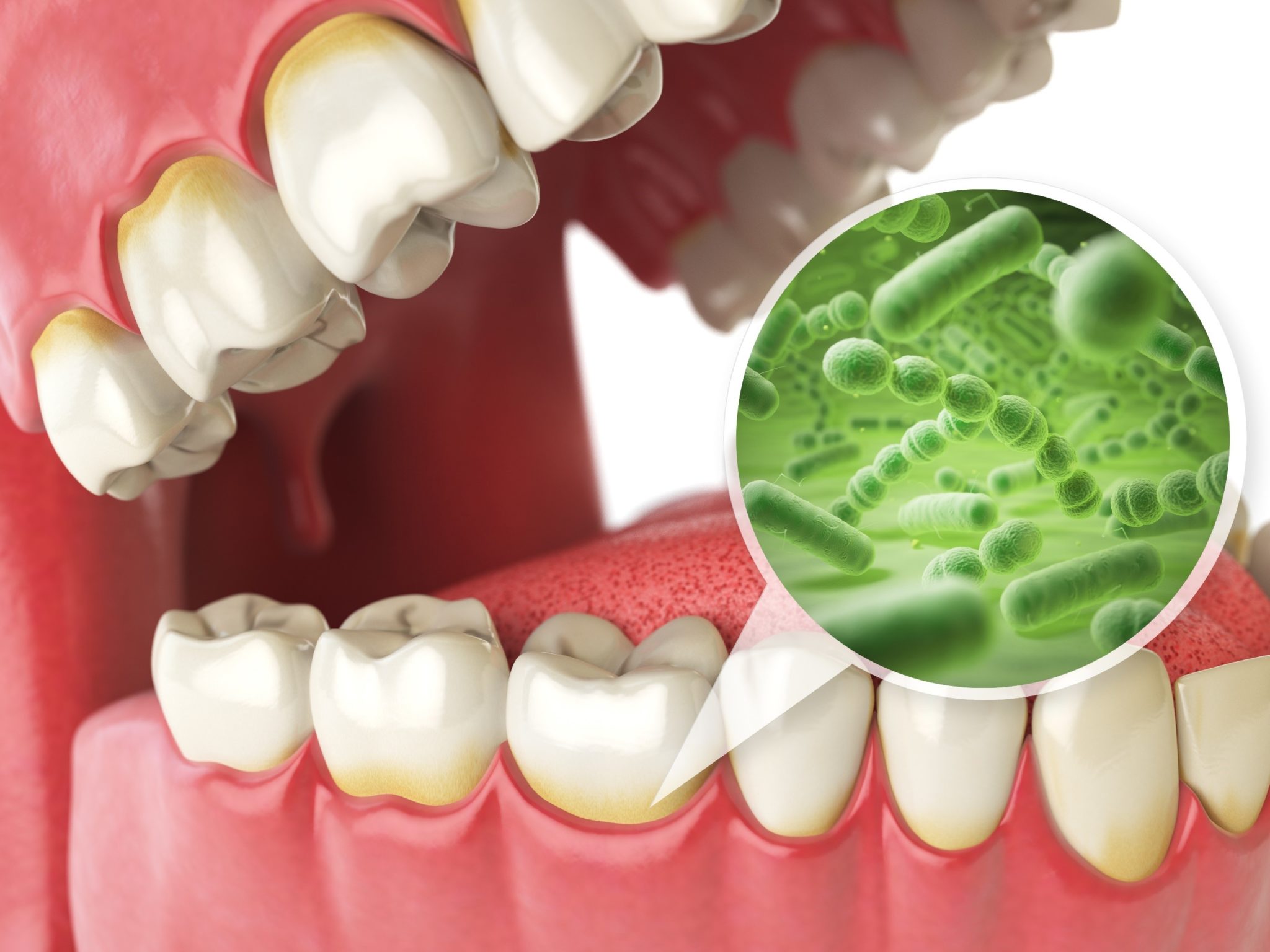 Connection Between Gum Disease And Respiratory Issues