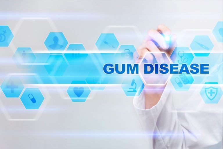 Benefit From Antibiotic Therapy for Gum Disease