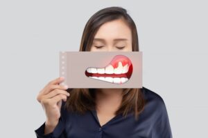 Young woman holding up model of gum disease with red, inflamed gums.